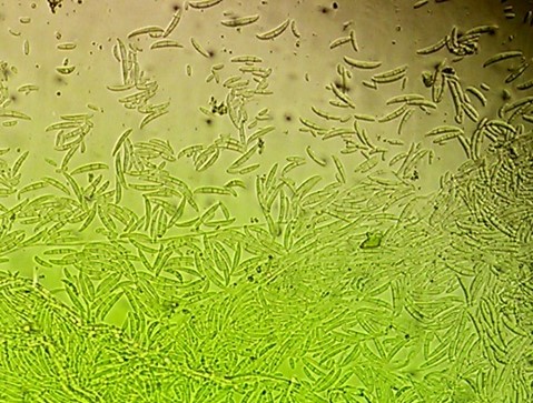 分生子の画像