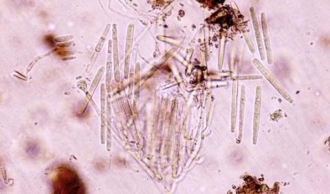 病原菌の分生子の画像