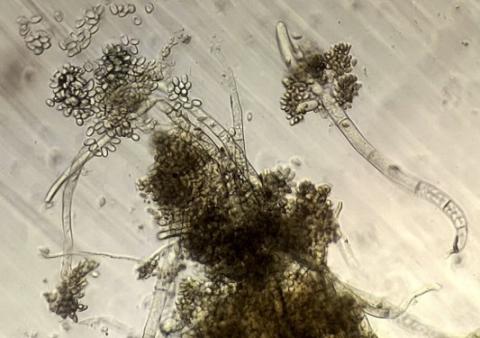 分生子の画像