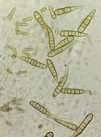 分生子の画像