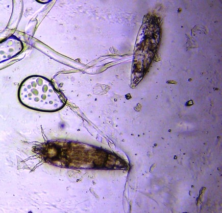 ニセナシサビダニ成虫の画像